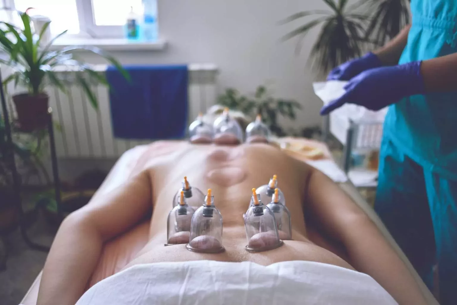 cupping therapy in downtown ottawa