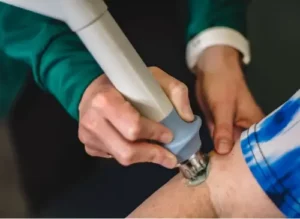 Shockwave Therapy - Ottawa Therapists Physiotherapy Treatments