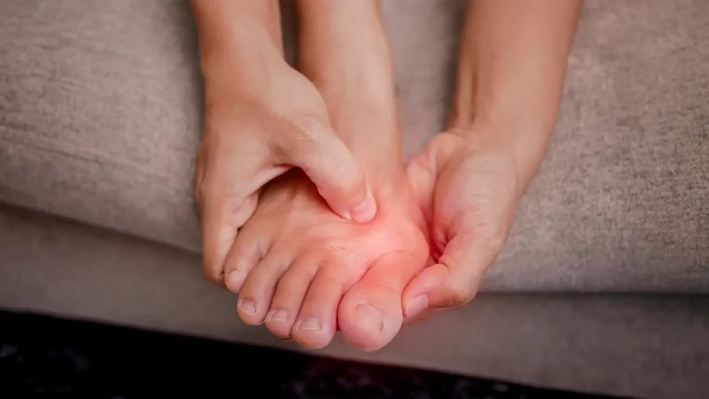 Bunion treatment in Ottawa