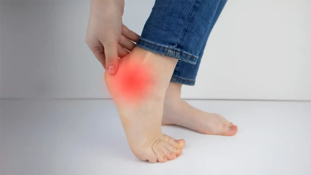Heel Spur Treatment ottawa