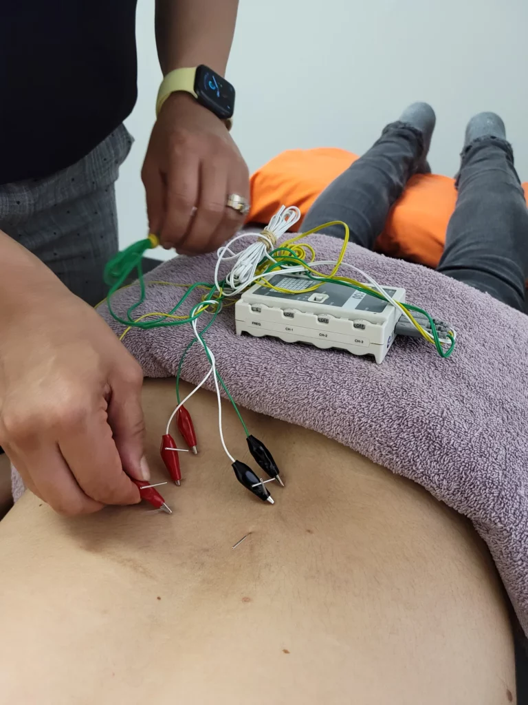 06 physiotherapy for sciatica electrotherapy lower back kent chiro med